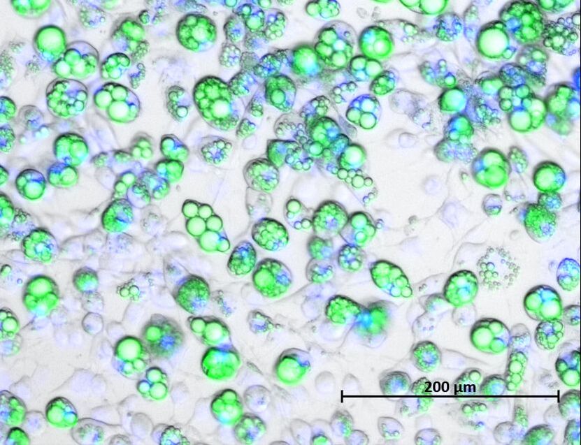Visualization of differentiated 3T3-L1 pre-adipocytes. Green staining depicts Nile Red-marked triglyceride accumulation and blue staining represents the Hoechst DNA stain as a marker of cell number.